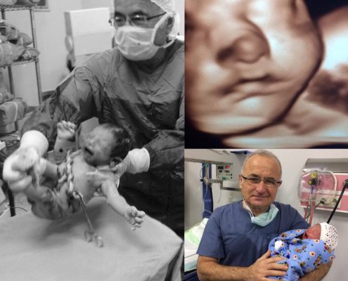 15036483_1361557920569312_4206322434946635689_n