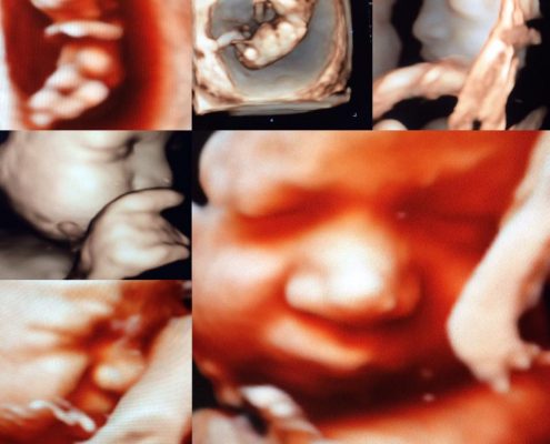 15134668_1378243818900722_3787905371689277491_n